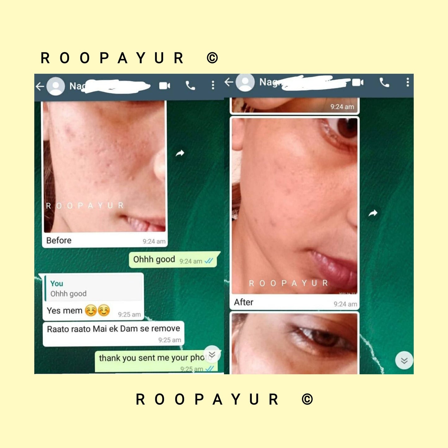 Roopayur Skin Healing Combo