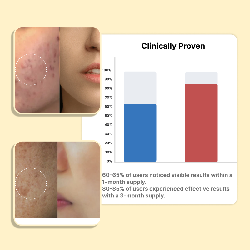Roopayur Scars Healing Mask for Acne Scars & Skin Renewal | ROOPAYUR