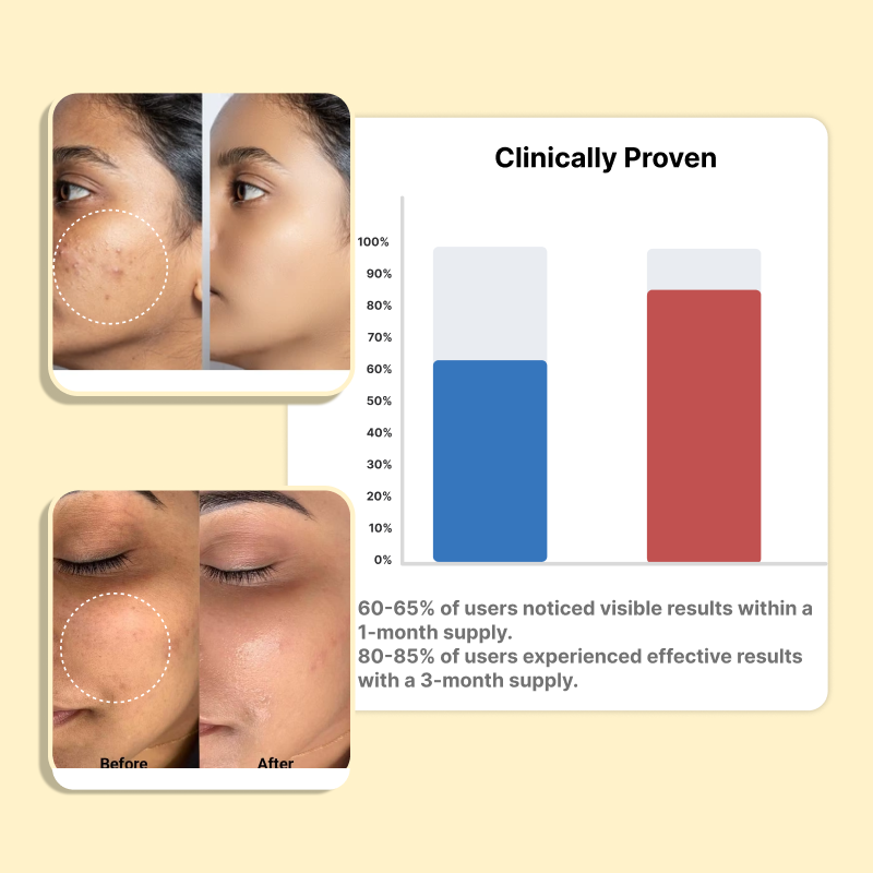 Roopayur Sunscreen SPF 50 for Daily Sun Protection | ROOPAYUR