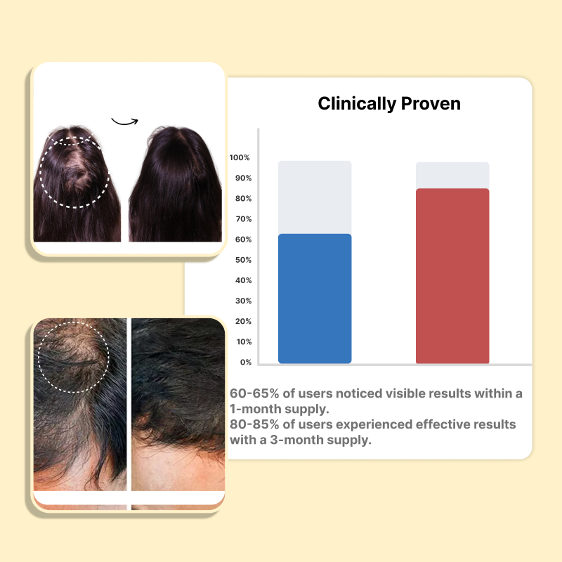Roopayur Biotin Capsules for Hair Growth & Strength | ROOPAYUR