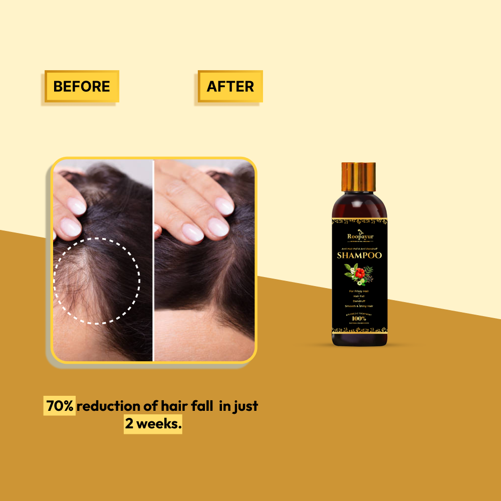 Roopayur Hair Oil