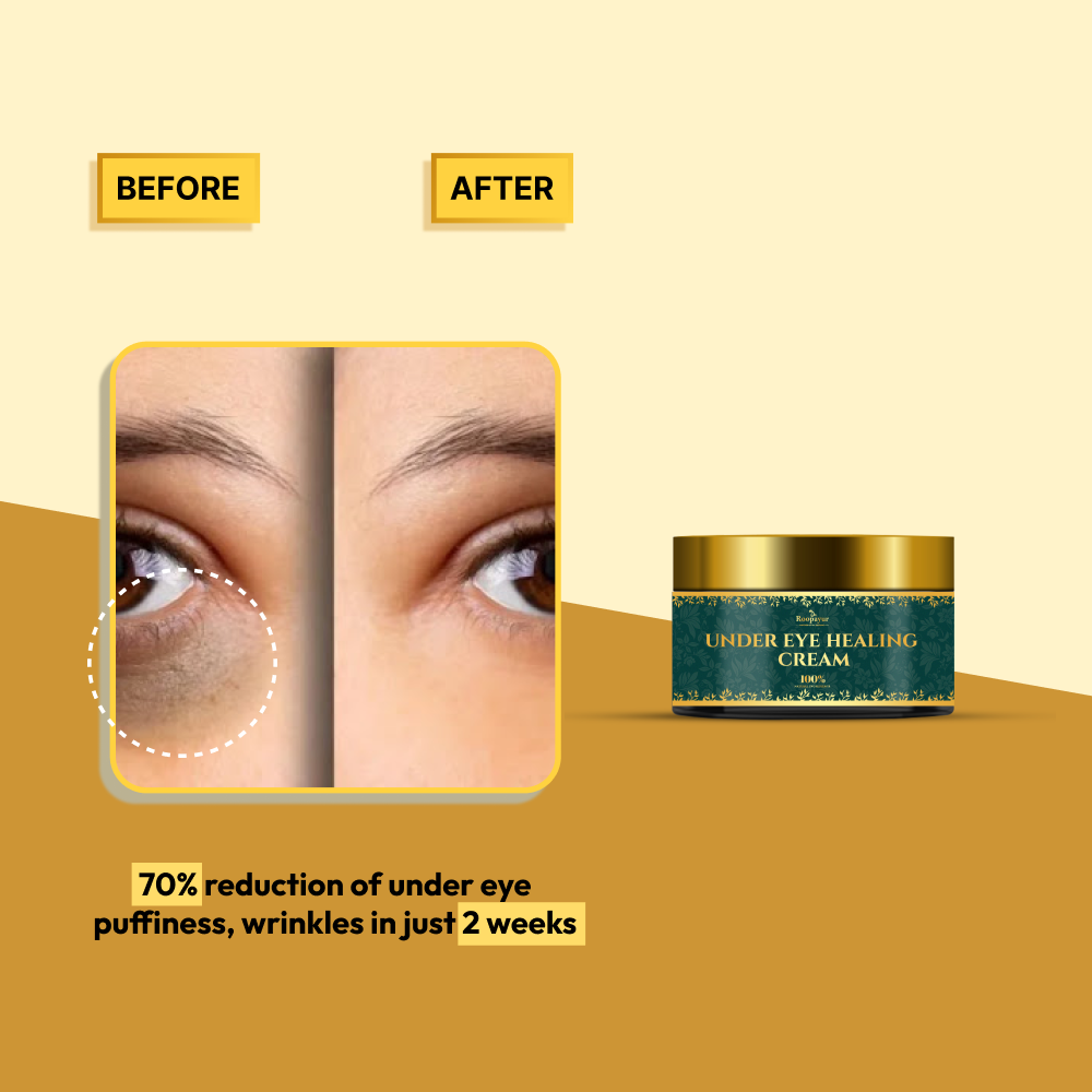 Roopayur UNDEREYE HEALING CREAM