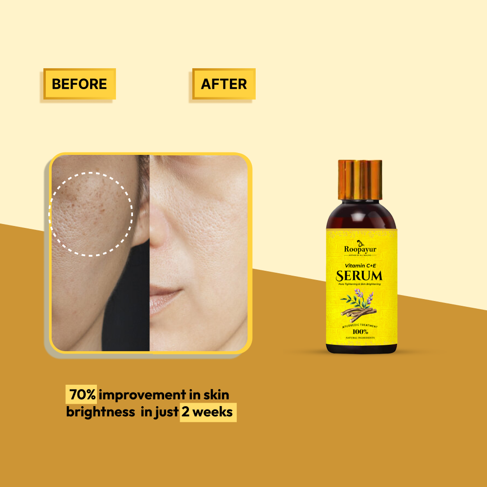 Roopayur Vitamin C and E Serum