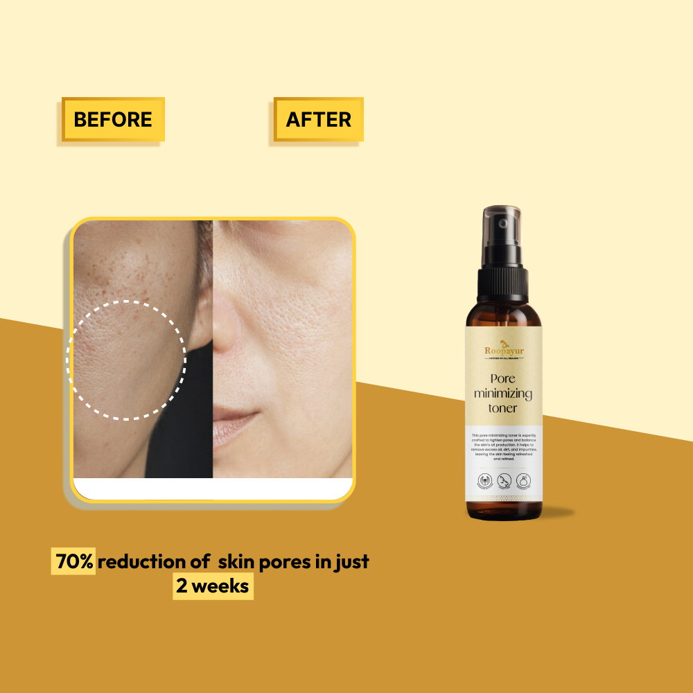 Pure Pore Minimizing Toner for Oily Skin, Large Pores & Acne | ROOPAYUR