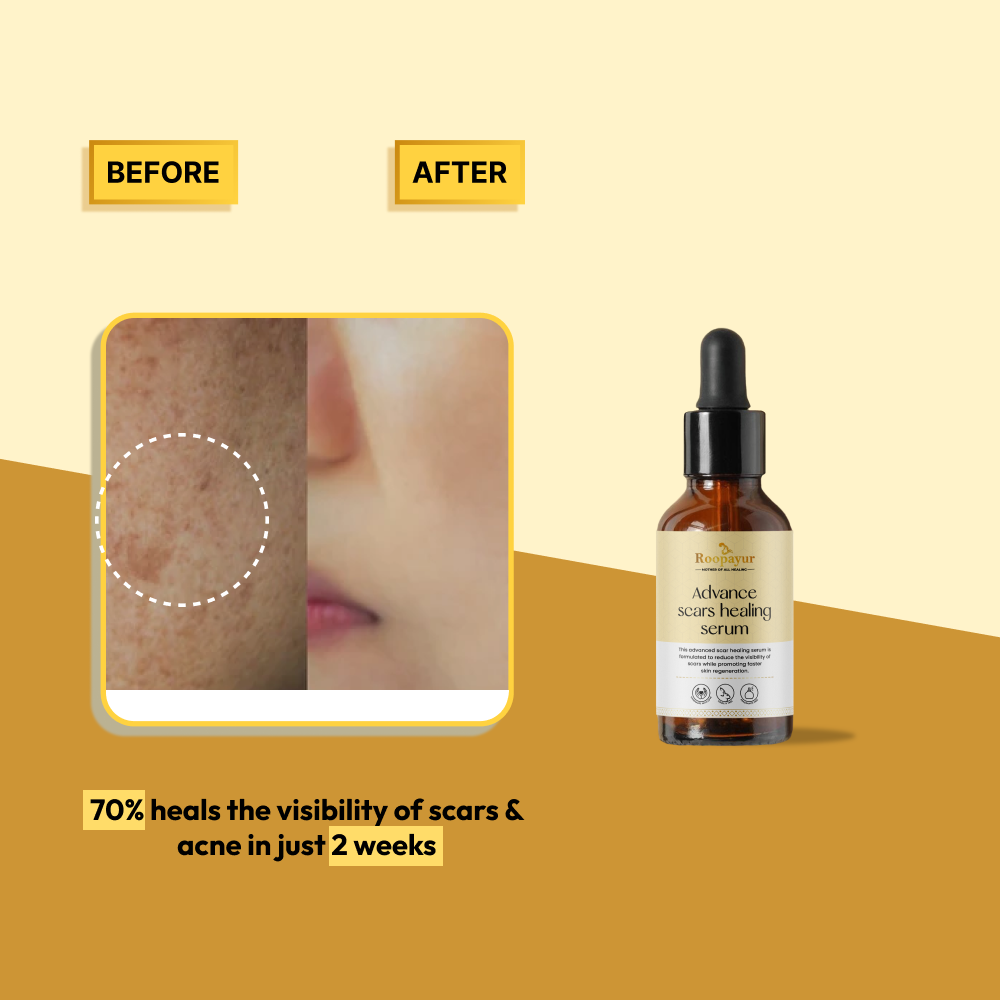 Roopayur Advanced Scars Healing Serum for Acne Scars & Pigmentation | ROOPAYUR