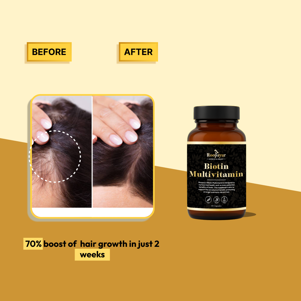 Roopayur Biotin Capsules for Hair Growth & Strength | ROOPAYUR